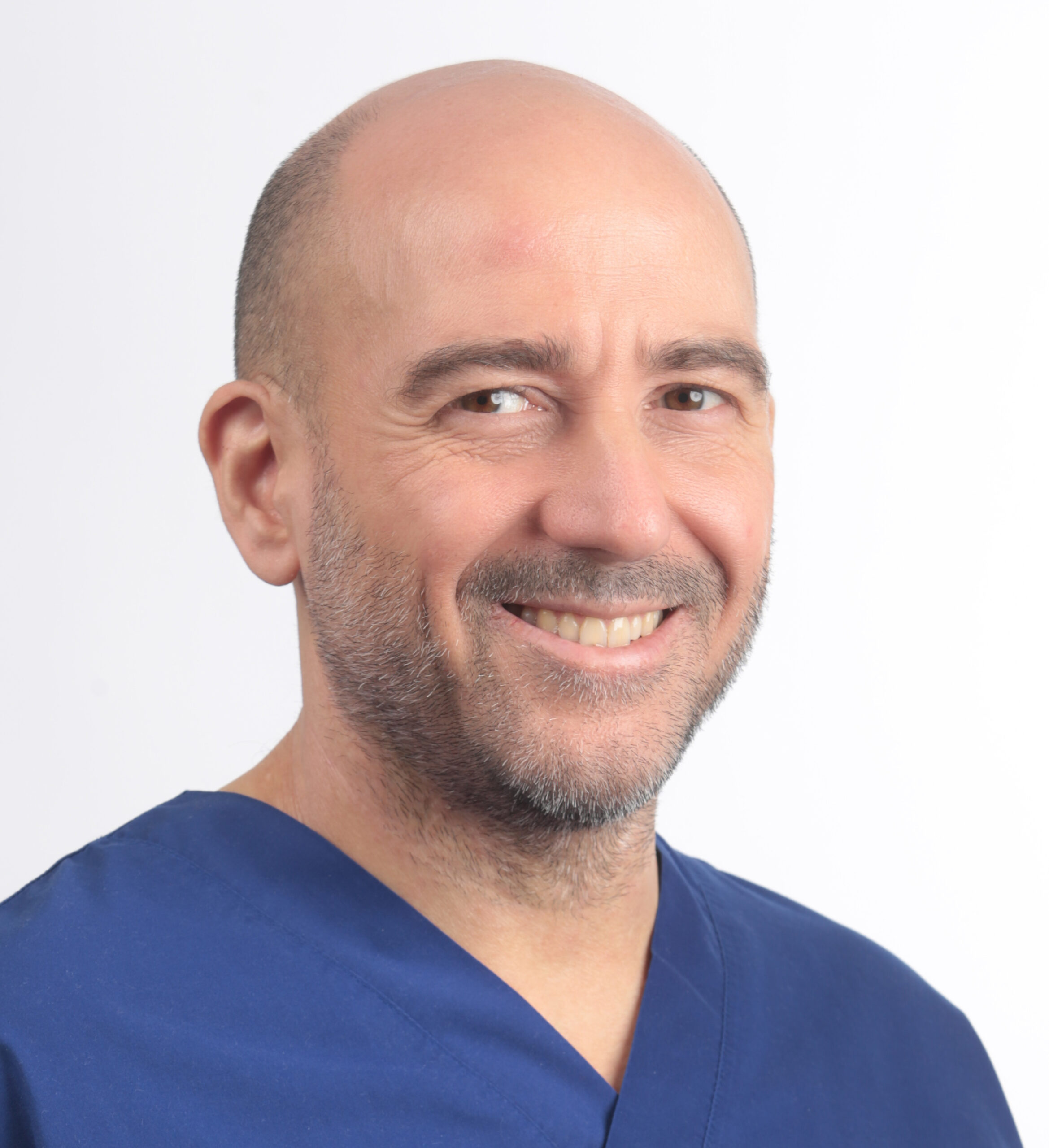 L’estrazione dei primi premolari superiori come mossa alternativa alla distalizzazione